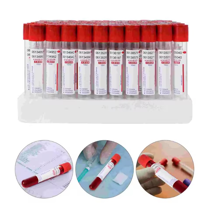 100pcs Disposable Vacuum Blood - Blood Collection Tube のレビューと価格