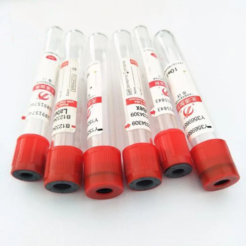 100pcs Disposable Vacuum Blood - Blood Collection Tube のレビューと価格