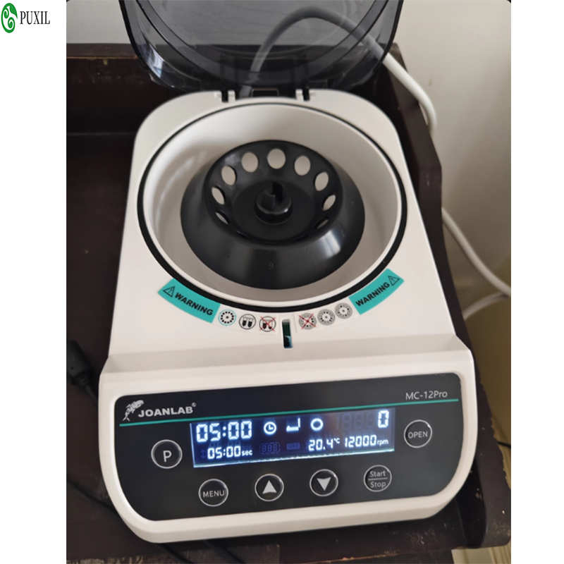 AB plasma centrifuge laborator - Blood Collection Tube のレビューと価格